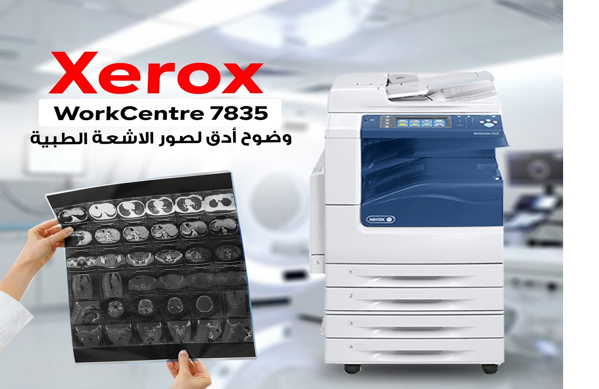 Xerox 7835 – The Smart Alternative to Traditional X-Ray Films